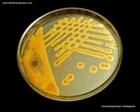 Chryseobacterium indologenes